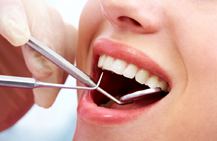 Dental Insurance